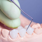 Periodontal Dental Treatment